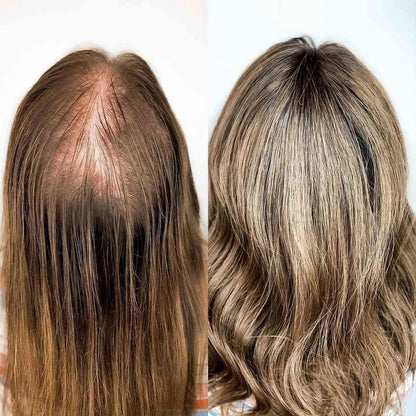 Softisso® Premium Hair Serum – Premium Daily Care to Beautify Your Hair & Hairline
